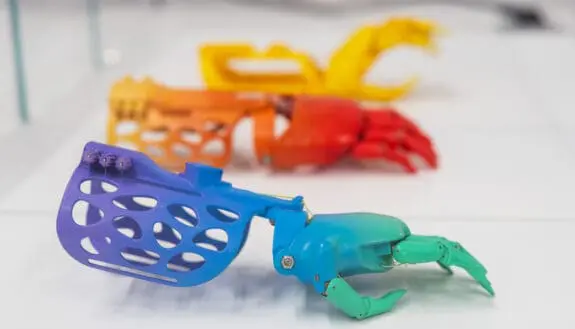 Iron Man’s Hand: Technion Gives Prosthetic Hands to Children