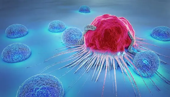 Fighting Tumors with Nanotech and Sound