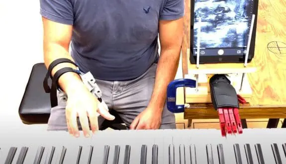 Giving Prosthetics a Hand