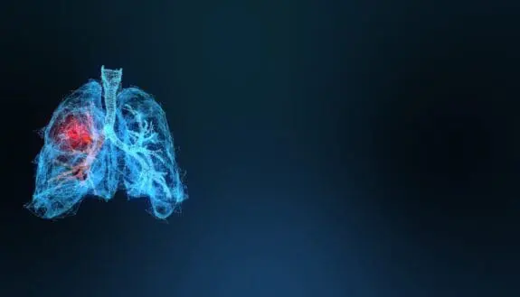 Lung Cancer Breakthrough? It’s Close