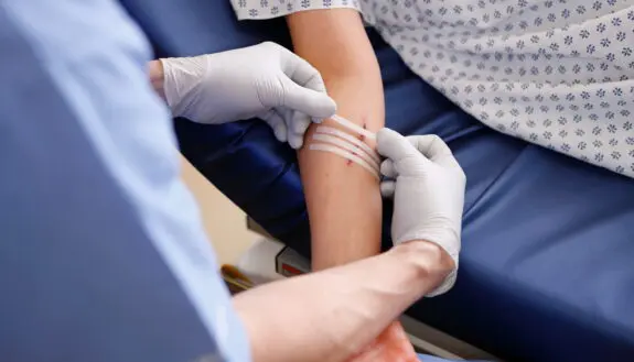 Biological Glue to Replace Stitches