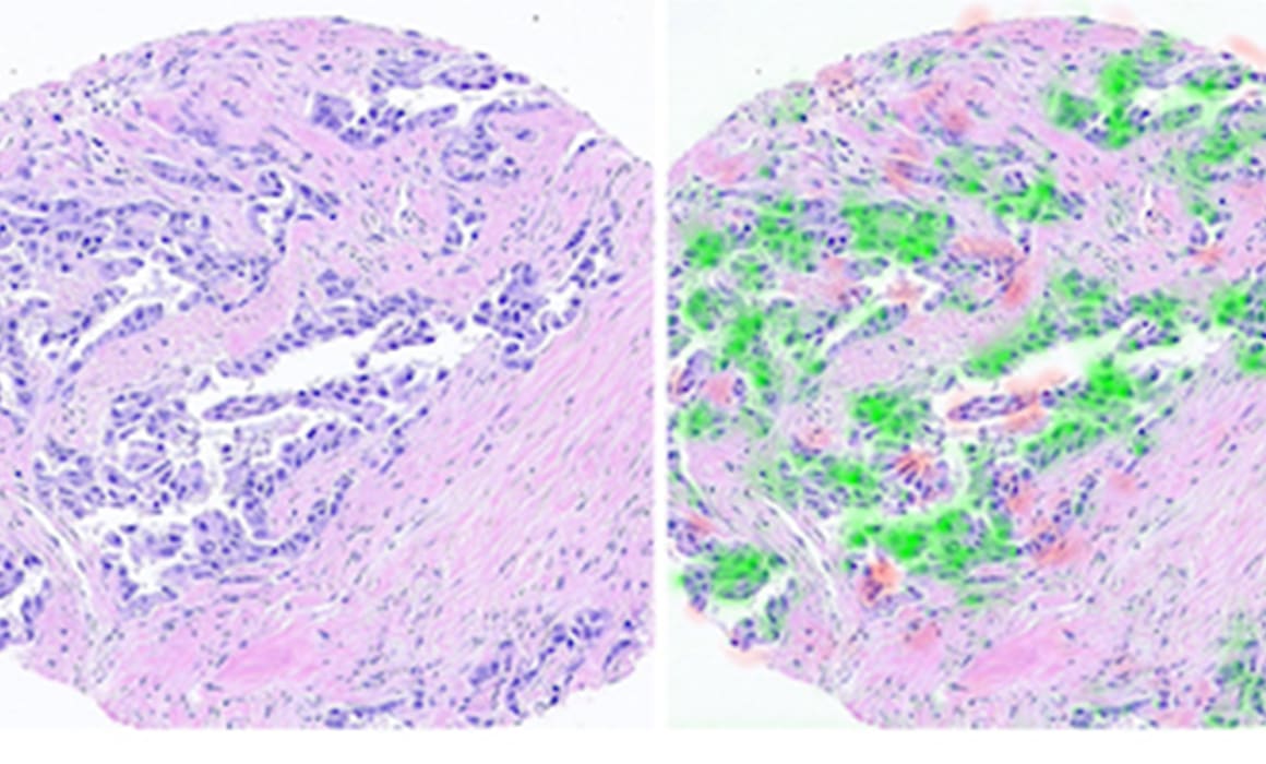 Computerized image of cells for AI pathologist | Donate to Support the Technion University | How to Donate to Support Israel