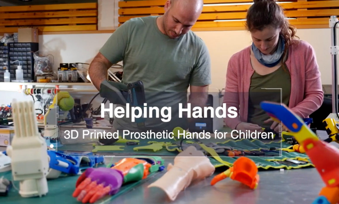 Screenshot from Helping Hands prosthetic video