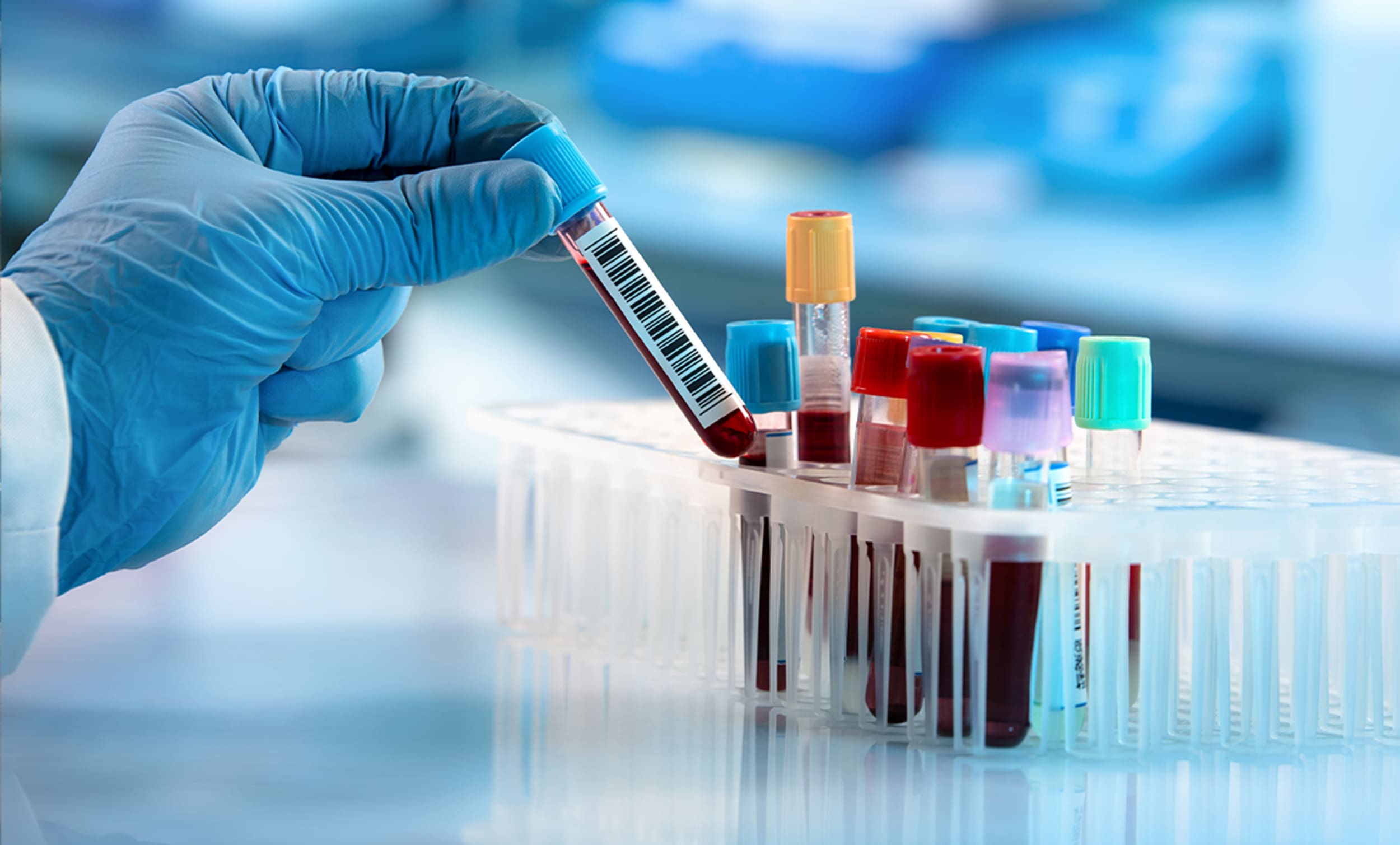 blood draw vials for rapid analysis with gloved scientist placing them in holder | Donate to Support Israel | Technion University