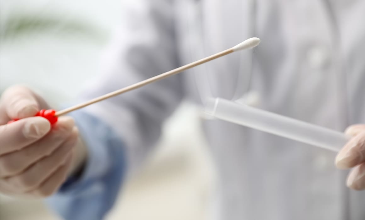 NaorCov19 rapid covid saliva test held by doctor in white coat | Technion University | How to Support Israel