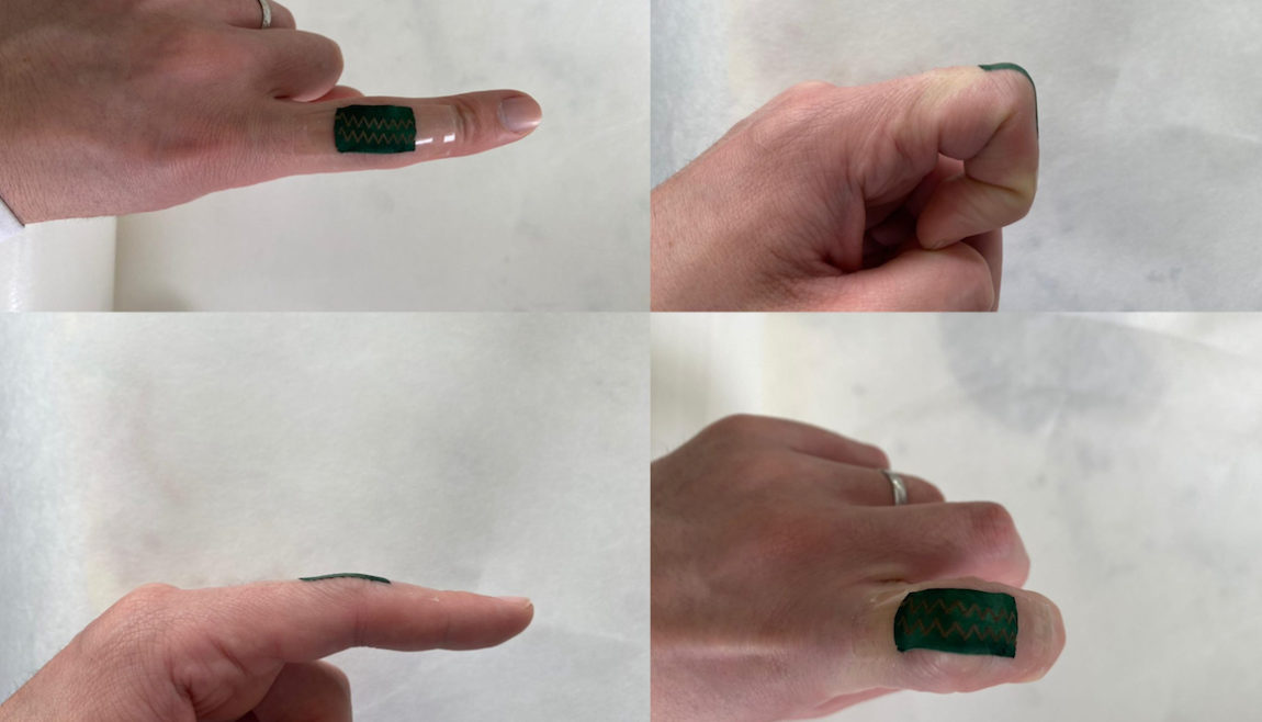 Impact - Technion scientists have created an electronic skin that can recognize the range of movement human joints normally make, with up to half a degree precision.