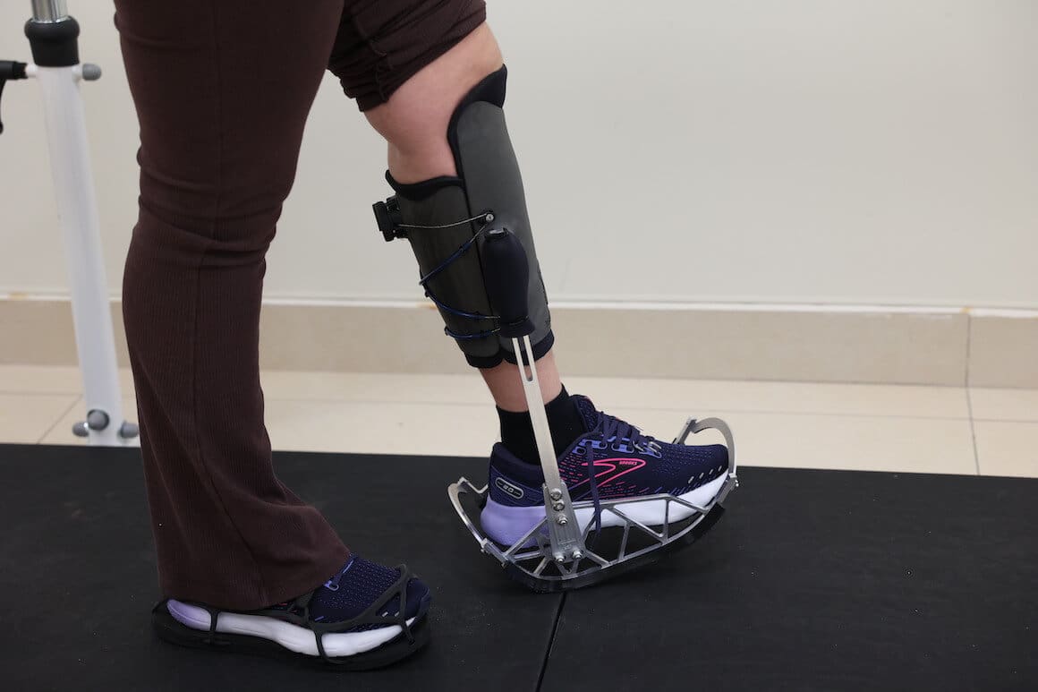 personalized orthotic device