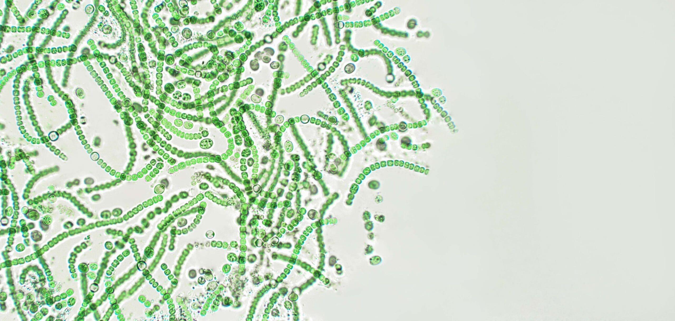 close up of green cyanobacteria viewed from a microscope