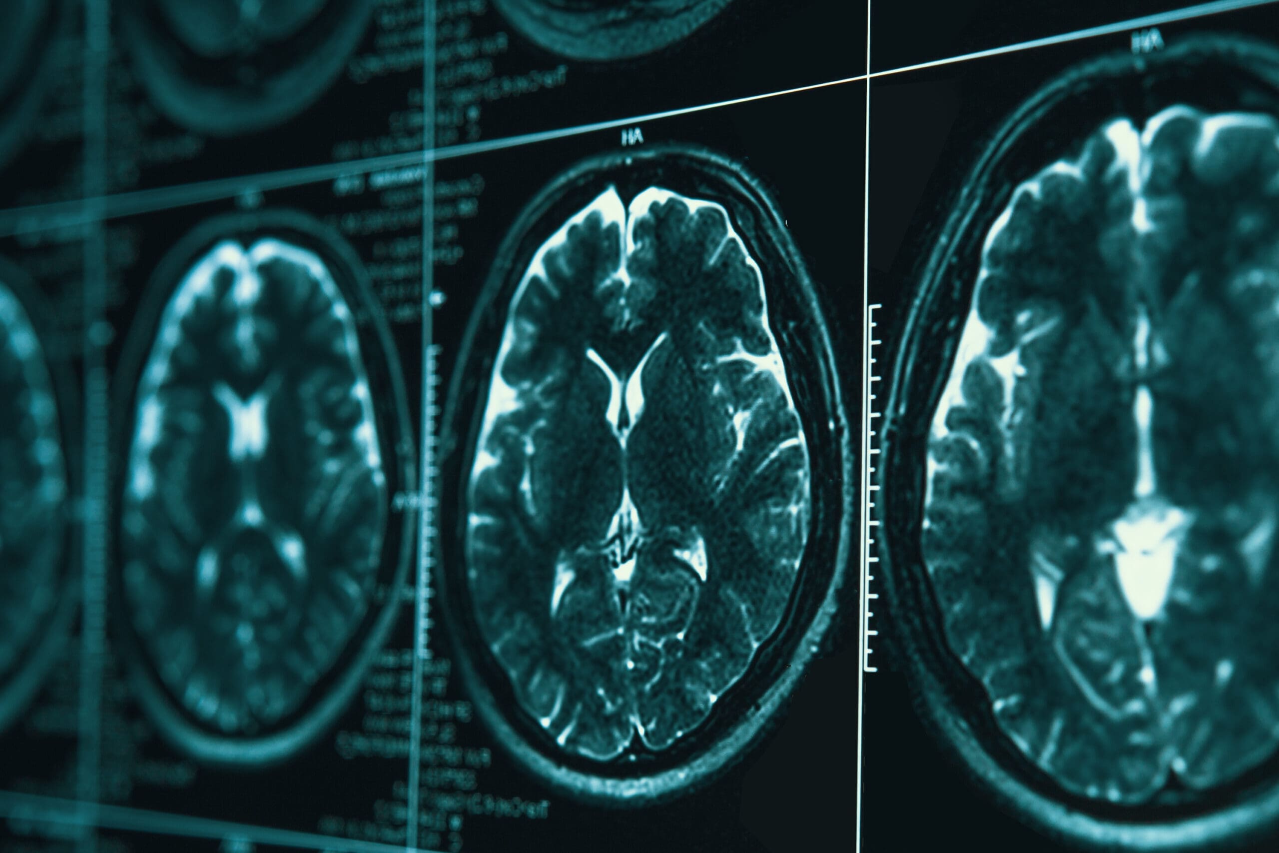 brain scan stock image | technion research alzheimer's | American Technion Society