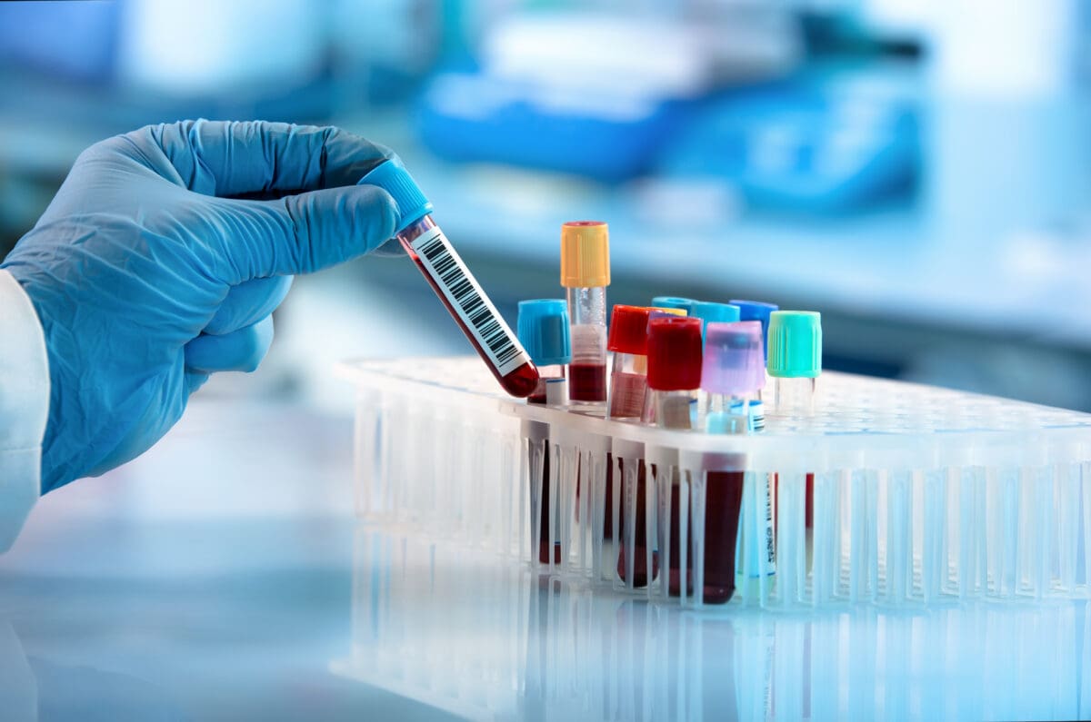 immune response test