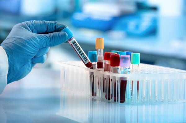 immune response test